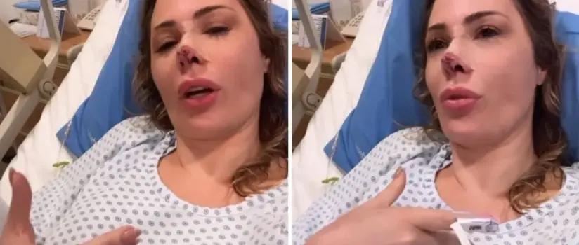 Ju Isen passa pela 3ª cirurgia no rosto após ataque de cachorro