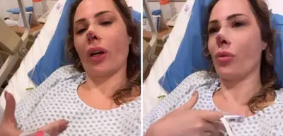 Ju Isen passa pela 3ª cirurgia no rosto após ataque de cachorro